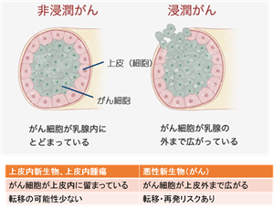 保険　乳がん
